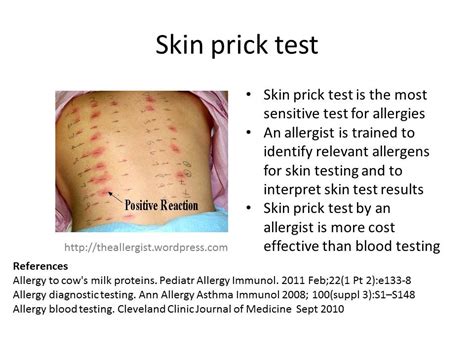 most accurate allergy testing method